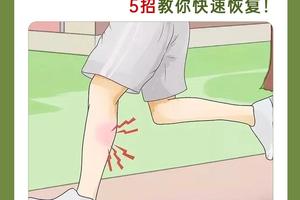 受伤后的篮球运动员如何进行康复训练:最佳策略与实践指南